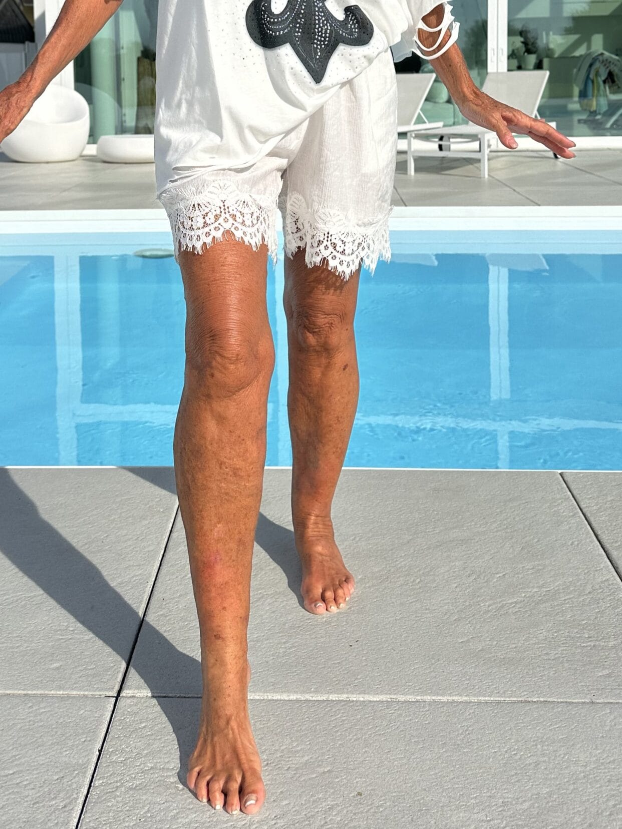 Shorts Spitzenzauber – Image 2
